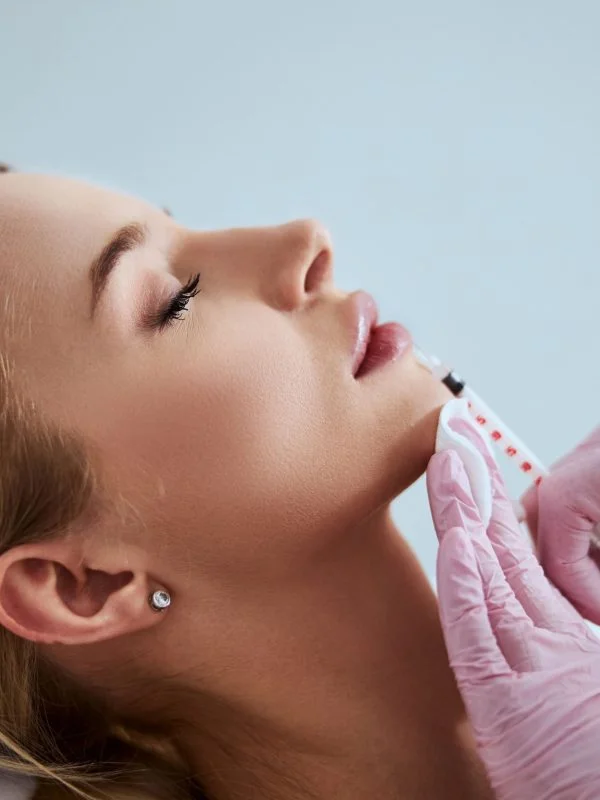 Dermal filler at Rejuven8 Medical in Sugar Land, TX