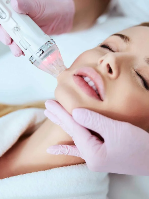 RF Microneedling at Rejuven8 Medical in Sugar Land, TX