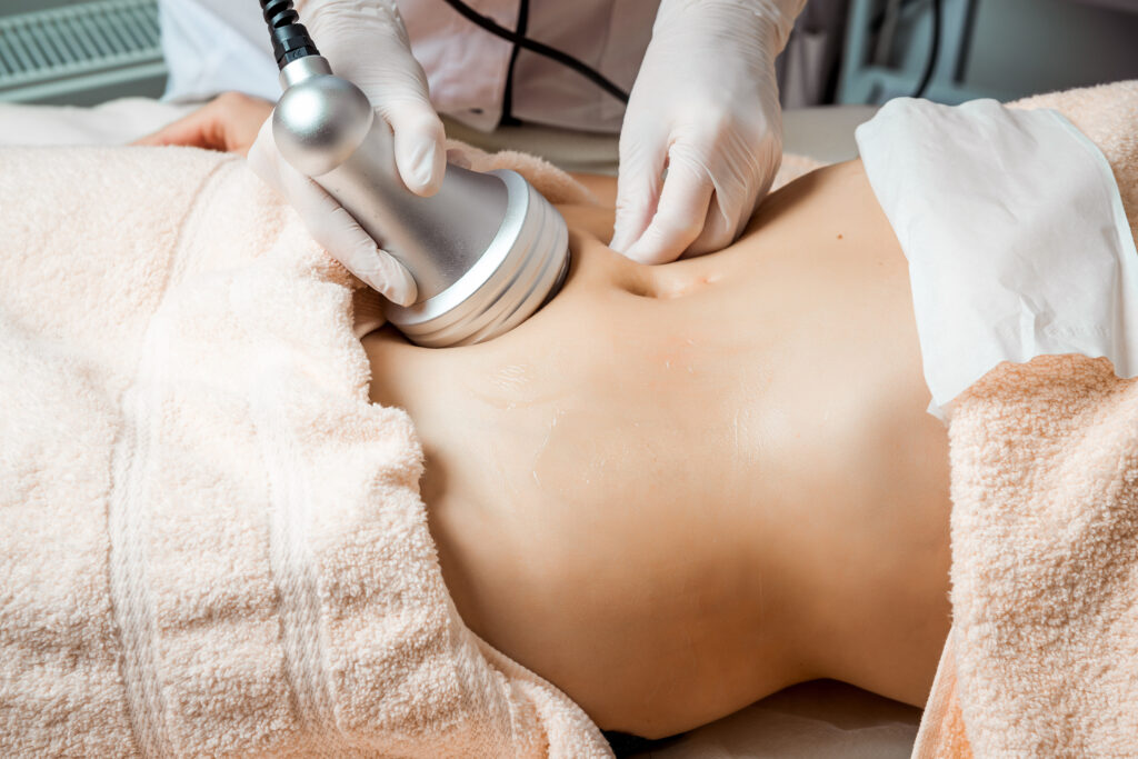 Ultrasound cavitation body contouring treatment at Rejuven8 Medical in Sugar Land, TX
